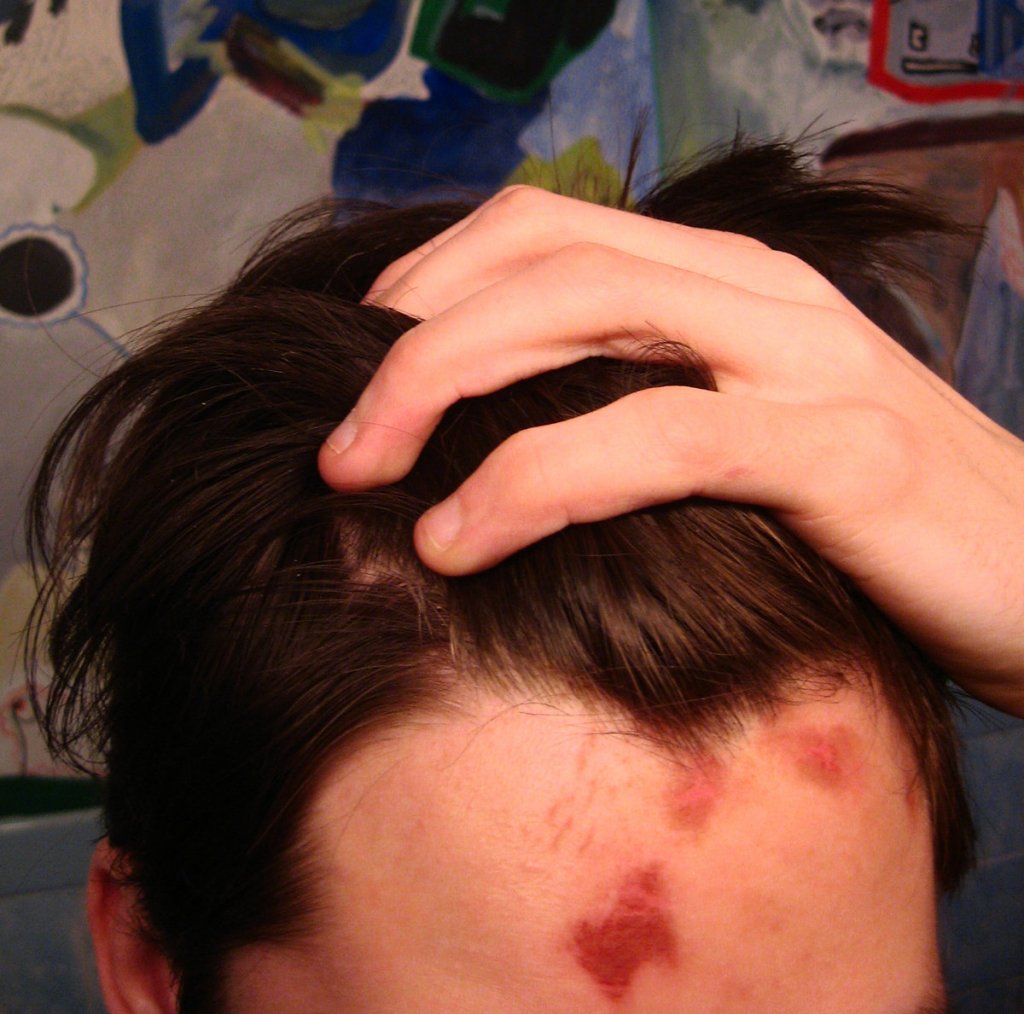 20,000 Albums for Eidelyn Gonzales: The Decline of Stupid Fucking Western&nbsp;Civilization